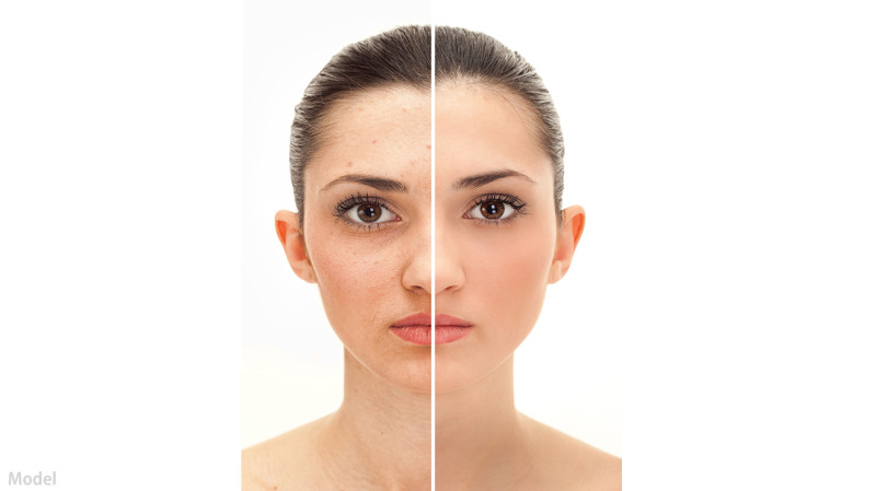 Improve-Skin-Tone-and-Texture1-e1459800782851